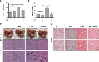 Noninvasive 40-Hz Light Flicker Rescues Circadian Behavior and Abnormal Lipid Metabolism Induced by Acute Ethanol Exposure via Improving SIRT1 and the Circadian Clock in the Liver-Brain Axis